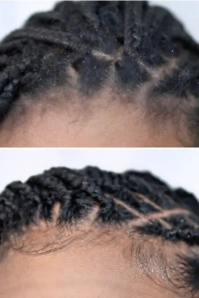 Retightening Refresh Box Braids Hair By Grace London Afro Hairdresser Black Hair Salon Near Me Braider FroHub
