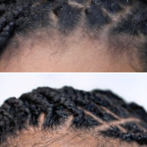 Retightening Refresh Box Braids Hair By Grace London Afro Hairdresser Black Hair Salon Near Me Braider FroHub